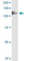 Protein Tyrosine Kinase 2 Beta antibody, H00002185-M01, Novus Biologicals, Immunoprecipitation image 