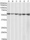 PHI antibody, PA5-19224, Invitrogen Antibodies, Western Blot image 