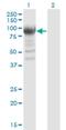 Ribonucleotide Reductase Catalytic Subunit M1 antibody, H00006240-M07, Novus Biologicals, Western Blot image 