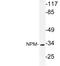 Nucleophosmin 1 antibody, LS-C176643, Lifespan Biosciences, Western Blot image 
