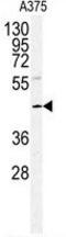 DNA Polymerase Delta Interacting Protein 2 antibody, GTX81346, GeneTex, Western Blot image 