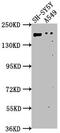 GLI Family Zinc Finger 2 antibody, CSB-PA009500OA01HU, Cusabio, Western Blot image 