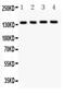 Abcb4 antibody, PA5-78692, Invitrogen Antibodies, Western Blot image 