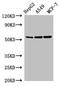 Solute Carrier Family 24 Member 5 antibody, orb53519, Biorbyt, Western Blot image 