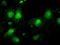 Interleukin Enhancer Binding Factor 2 antibody, GTX84290, GeneTex, Immunofluorescence image 