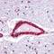 BRCA1 DNA Repair Associated antibody, NB100-404, Novus Biologicals, Immunohistochemistry frozen image 