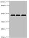 Phosphatidylinositol-5-Phosphate 4-Kinase Type 2 Beta antibody, orb352523, Biorbyt, Western Blot image 