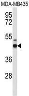 Gamma-Aminobutyric Acid Type A Receptor Delta Subunit antibody, GTX80429, GeneTex, Western Blot image 