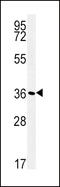 ATPase Na+/K+ Transporting Subunit Beta 1 antibody, 62-080, ProSci, Western Blot image 
