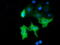 Myotubularin Related Protein 14 antibody, M08168, Boster Biological Technology, Immunofluorescence image 