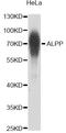 PLAP-1 antibody, STJ28436, St John