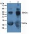  Glycated hemoglobin A1c  antibody, MBS2003217, MyBioSource, Western Blot image 