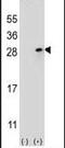 Fibroblast Growth Factor 9 antibody, PA5-23719, Invitrogen Antibodies, Western Blot image 