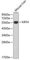 Keratin 4 antibody, 18-753, ProSci, Western Blot image 