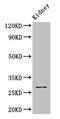Glutathione S-Transferase Mu 3 antibody, CSB-PA009982LA01HU, Cusabio, Western Blot image 