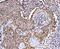 MAF BZIP Transcription Factor F antibody, A07784-2, Boster Biological Technology, Immunohistochemistry paraffin image 
