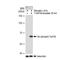 SRC Proto-Oncogene, Non-Receptor Tyrosine Kinase antibody, GTX03226, GeneTex, Western Blot image 