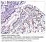 CD99 Molecule (Xg Blood Group) antibody, CD99-101AP, FabGennix, Immunohistochemistry paraffin image 