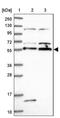 Acrosin Binding Protein antibody, PA5-58650, Invitrogen Antibodies, Western Blot image 