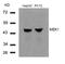 Mitogen-Activated Protein Kinase Kinase 1 antibody, 79-400, ProSci, Western Blot image 