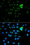 p21 antibody, STJ113149, St John