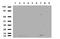 Gamma-Butyrobetaine Hydroxylase 1 antibody, LS-C799962, Lifespan Biosciences, Western Blot image 