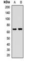 Ubiquilin 2 antibody, orb412873, Biorbyt, Western Blot image 