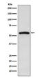 Interleukin 1 Receptor Associated Kinase 4 antibody, M01247, Boster Biological Technology, Western Blot image 