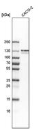 Renal carcinoma antigen NY-REN-6 antibody, PA5-58320, Invitrogen Antibodies, Western Blot image 