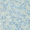 CCAAT Enhancer Binding Protein Alpha antibody, 13-318, ProSci, Immunohistochemistry paraffin image 