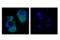 Protein Tyrosine Kinase 6 antibody, 55174S, Cell Signaling Technology, Immunocytochemistry image 