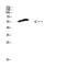 Collagen Type XXV Alpha 1 Chain antibody, A08068, Boster Biological Technology, Western Blot image 