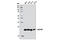 Calcyclin Binding Protein antibody, 8225S, Cell Signaling Technology, Western Blot image 