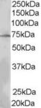 SH2B Adaptor Protein 3 antibody, STJ70582, St John