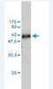 WD Repeat Domain 6 antibody, H00011180-M01, Novus Biologicals, Western Blot image 