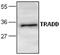 TNFRSF1A Associated Via Death Domain antibody, GTX59659, GeneTex, Western Blot image 