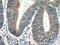 Mitochondrial Ribosomal Protein L55 antibody, 17679-1-AP, Proteintech Group, Immunohistochemistry paraffin image 