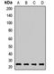 RAB2A, Member RAS Oncogene Family antibody, LS-C667993, Lifespan Biosciences, Western Blot image 