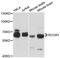 REST Corepressor 1 antibody, A12845, ABclonal Technology, Western Blot image 