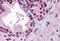 Androgen Receptor antibody, MBS246169, MyBioSource, Immunohistochemistry paraffin image 