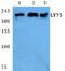 Lymphocyte Antigen 75 antibody, A08183, Boster Biological Technology, Western Blot image 