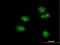 Forkhead Box A2 antibody, H00003170-M11, Novus Biologicals, Immunocytochemistry image 
