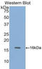 Fatty Acid Binding Protein 1 antibody, LS-C292420, Lifespan Biosciences, Western Blot image 