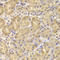 Death-associated protein kinase 1 antibody, STJ28308, St John