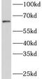 Zinc Finger Protein 571 antibody, FNab09715, FineTest, Western Blot image 