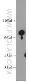 Mesoderm induction early response protein 1 antibody, 11452-1-AP, Proteintech Group, Western Blot image 