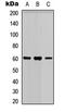 Poly [ADP-ribose] polymerase 3 antibody, abx121544, Abbexa, Western Blot image 