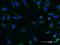 Salt Inducible Kinase 2 antibody, H00023235-M03, Novus Biologicals, Immunocytochemistry image 