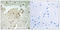 X-Ray Repair Cross Complementing 6 antibody, LS-C199177, Lifespan Biosciences, Immunohistochemistry paraffin image 