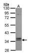 G Protein-Coupled Bile Acid Receptor 1 antibody, GTX100026, GeneTex, Western Blot image 